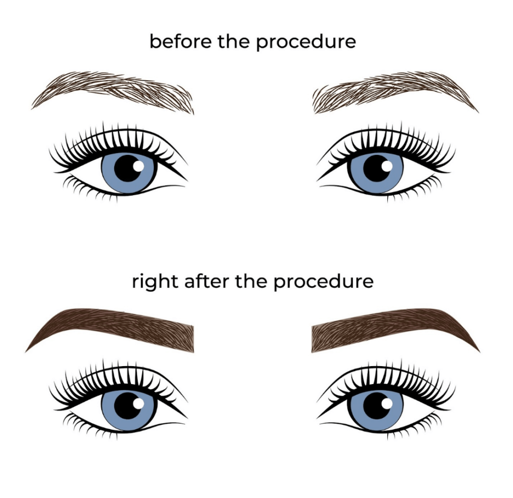 What Are The Microblading Healing Stages?